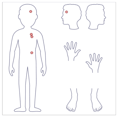 Body Maps Safeguarding Designated Safeguard Lead Body Map