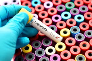Legionella risk assessment