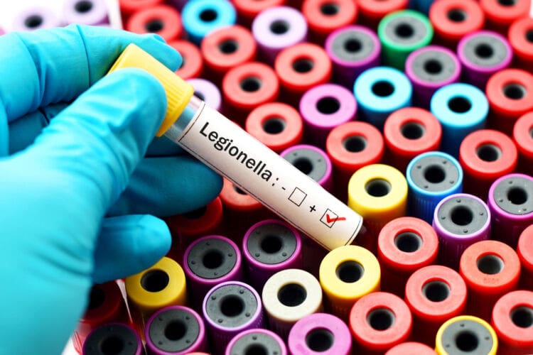 Legionella risk assessment