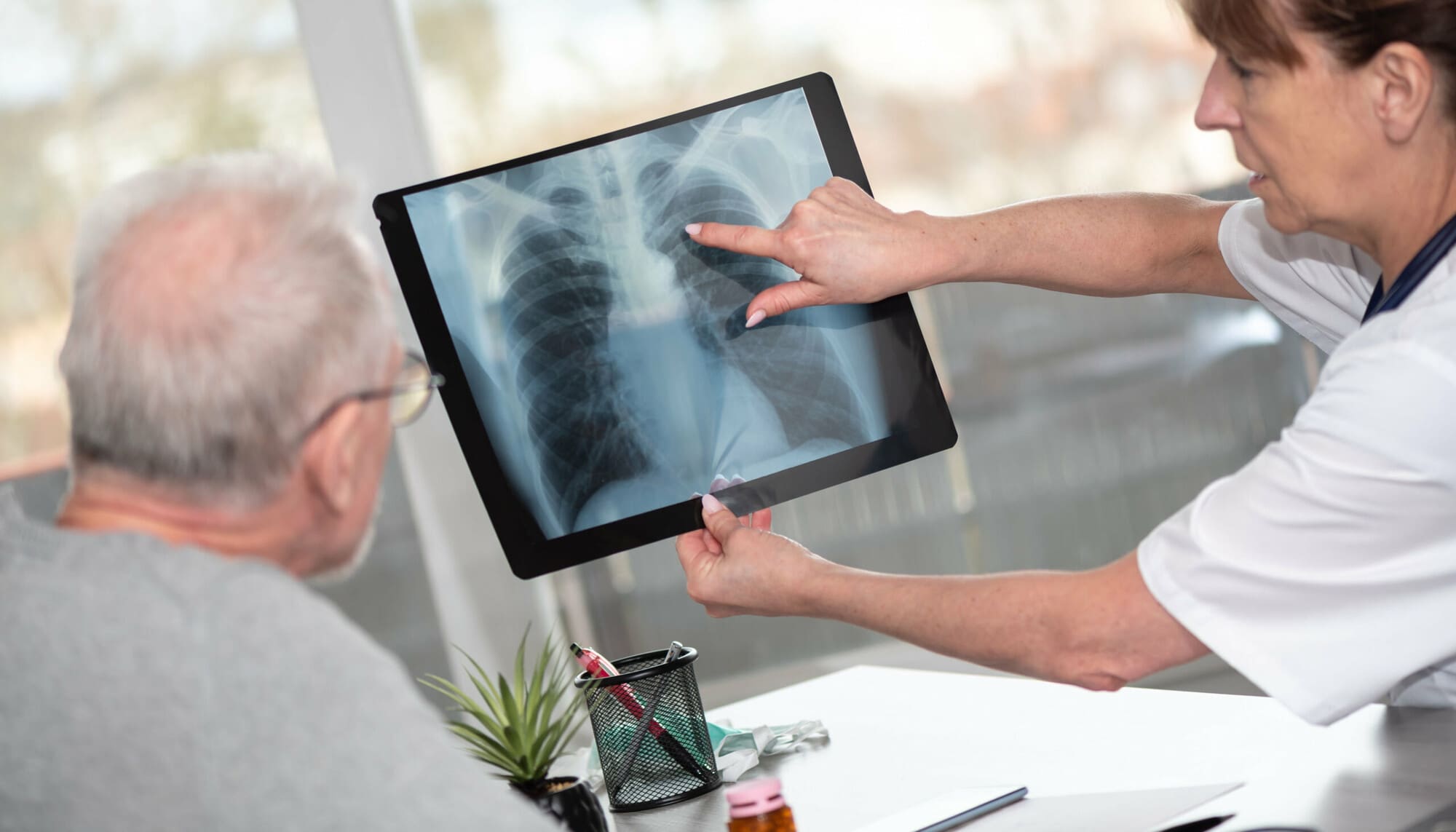 Doctor showing man with pneumonia x-ray of his lungs Doctor showing man with pneumonia x-ray of his lungs