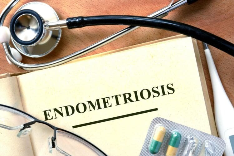 What is Endometriosis?