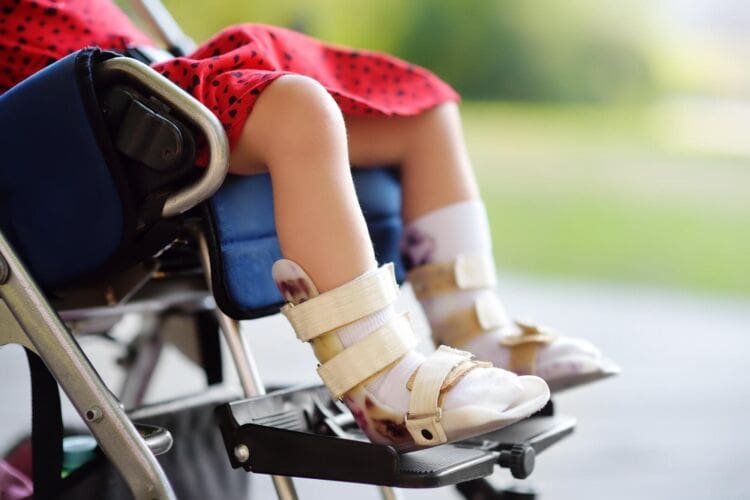 What Is Cerebral Palsy