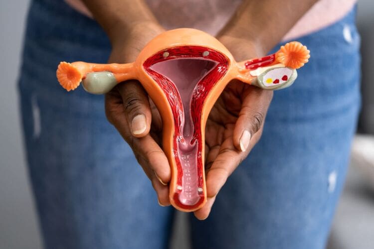 What is cervical cancer