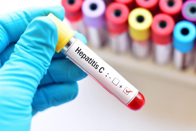 What is Hepatitis?