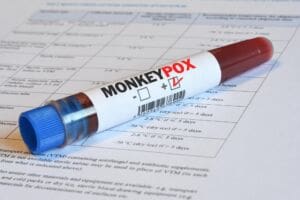 What is monkeypox