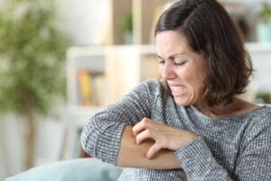 What is psoriasis
