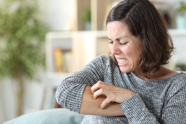 What is psoriasis