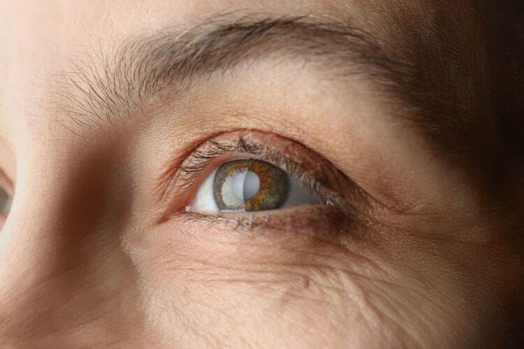 All about cataracts