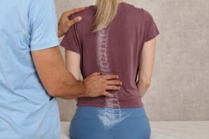 All about scoliosis