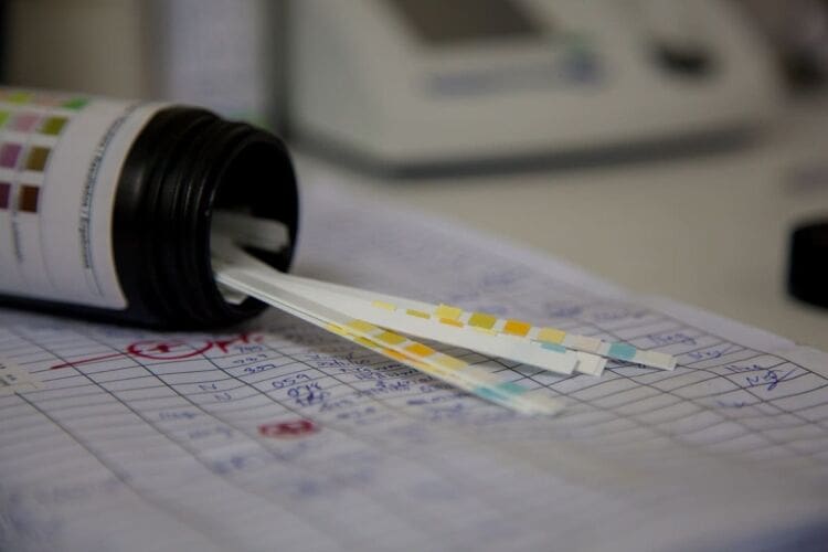 Everything you need to know about workplace drug testing