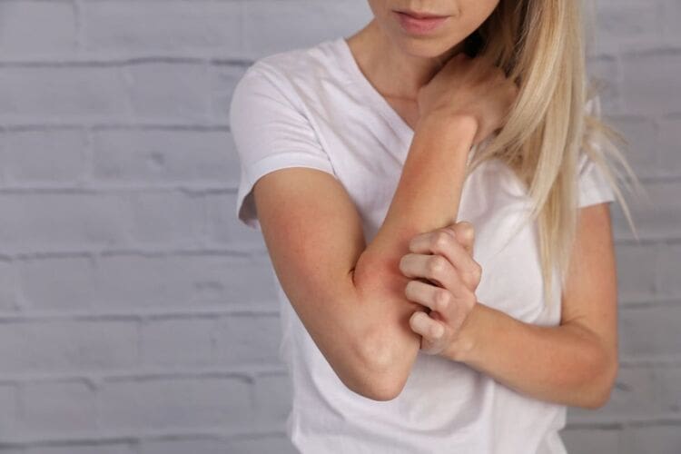 All about dermatillomania