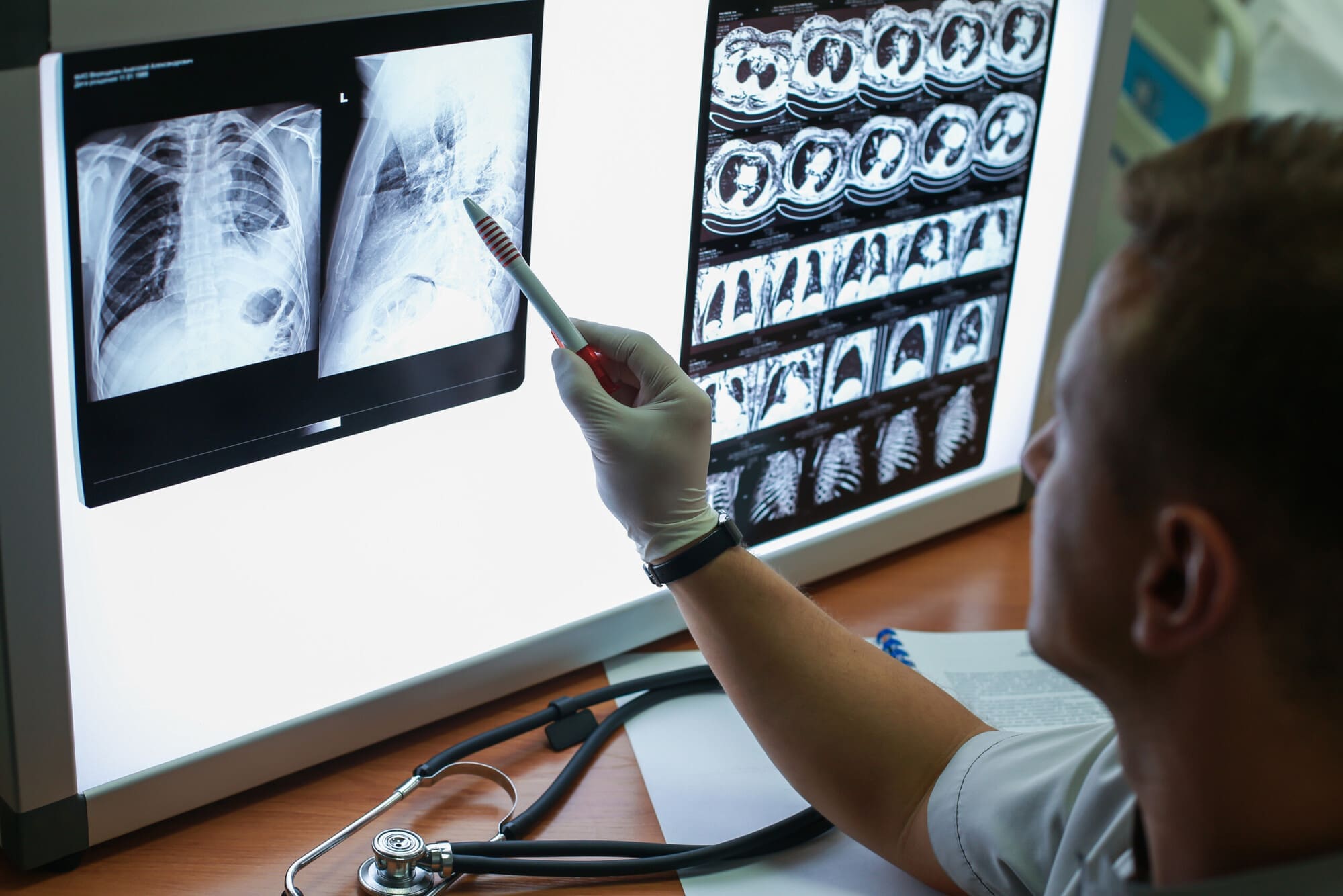 Radiographer Going Over X-Rays