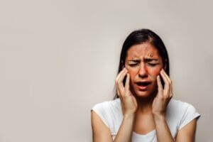 All About Chemical Burns