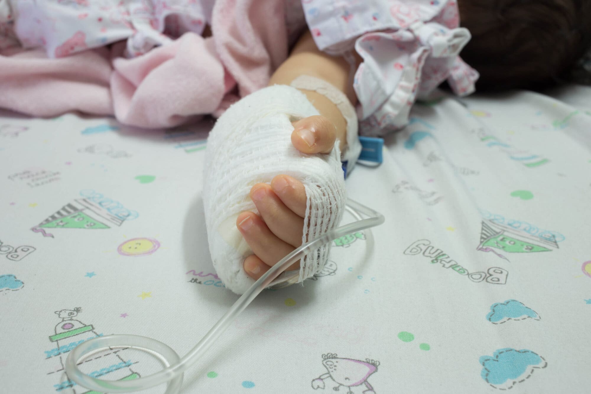 How to Treat a Chemical Burn